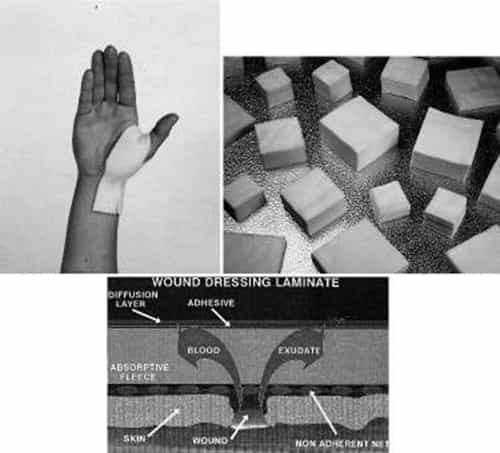 Fig 4.2 Wound dressings. (a) and (b) wound dressings, (c) wound dressing concept.