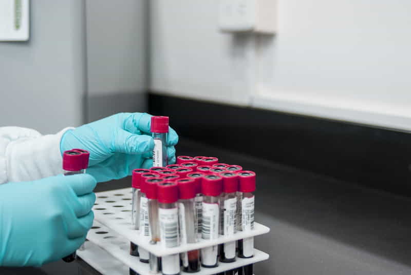lab testing