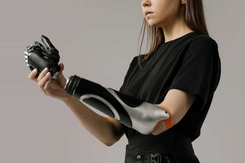 prosthetic hand