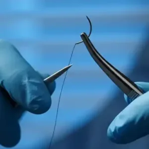 Best Silk Types for Medical Sutures